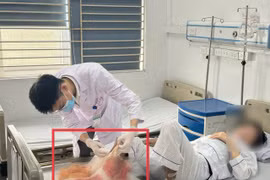 Bệnh nhân nhập viện trong tình trạng cẳng chân hoại tử nặng, bốc mùi hôi thối. (Ảnh: PV/Vietnam+)