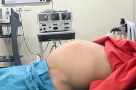 Khi bệnh nhân nhập viện, khối u đã phát triển rất to, tương đương thai 9 tháng. (Ảnh: PV/Vietnam+)