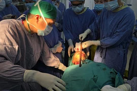 Các bác sỹ phẫu thuật lấy thanh sắt ra khỏi mặt cho bệnh nhân. (Ảnh: PV/Vietnam+) 