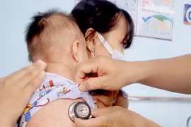 Bác sĩ thăm khám, điều trị cho trẻ mắc bệnh sởi. (Ảnh: TTXVN/Vietnam+)
