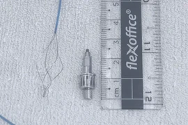 Dị vật là dụng cụ nha khoa bằng kim loại dài 2,5 cm được các bác sỹ lấy ra khỏi phế quản của bệnh nhân. (Ảnh: PV/Vietnam+)