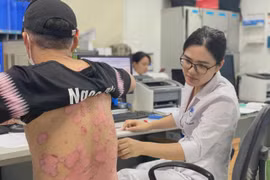 Bác sỹ khám cho một bệnh nhân mắc vảy nến. (Ảnh: PV/Vietnam+)