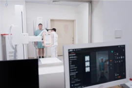 Các thiết bị X-quang, nhũ ảnh và siêu âm thế hệ mới hỗ trợ tầm soát bệnh. (Ảnh: PV/Vietnam+)