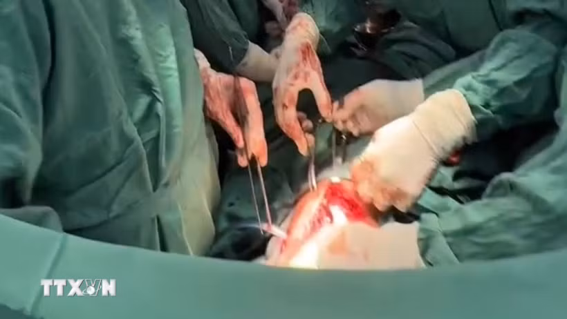 Các y, bác sỹ Bệnh viện đa khoa Bạc Liêu phẫu thuật khâu vết thương tâm thất trái, xử lý nhu mô phổi bị thủng và dẫn lưu màng phổi nhằm giữ lại sự sống cho Bet88com casino, thể thao, bắn cá, nổ hũ L.T.Đ. (Ảnh: TTXVN phát)