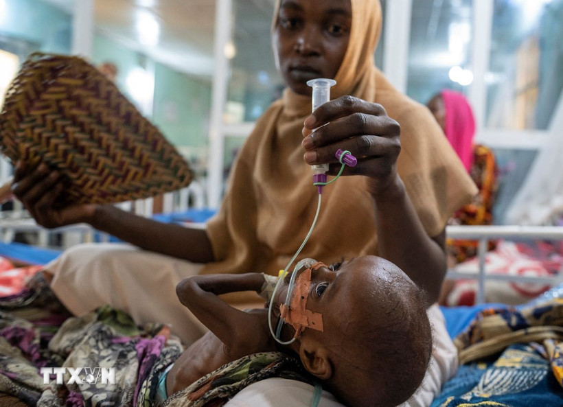 Em nhỏ bị suy dinh dưỡng được điều trị tại N'djamena, CH Chad. (Ảnh: AFP/TTXVN)