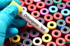 Hiện nay, dịch bệnh Chikungunya đang có xu hướng gia tăng. (Ảnh: PV/Vietnam+)