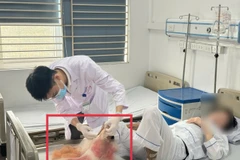 Bệnh nhân nhập viện trong tình trạng cẳng chân hoại tử nặng, bốc mùi hôi thối. (Ảnh: PV/Vietnam+)