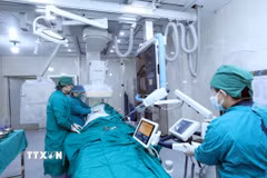 Bác sỹ sử dụng Hệ thống chụp và can thiệp mạch số hóa xóa nền (DSA) hiện đại. (Ảnh: Anh Tuấn/TTXVN)