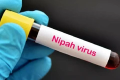 Ảnh minh họa. (Nguồn: AFP)