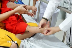Trẻ em bị bệnh tay chân miệng đang điều trị tại bệnh viện. (Ảnh: TTXVN phát)