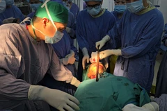 Các bác sỹ phẫu thuật lấy thanh sắt ra khỏi mặt cho bệnh nhân. (Ảnh: PV/Vietnam+) 