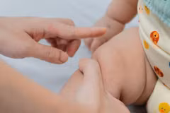 Biểu hiện lâm sàng bệnh tay chân miệng thường có nốt đỏ ở chân, tay và miệng. (Ảnh: Minh Quyết/TTXVN)