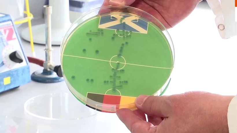Kết quả dự đoán bằng vi khuẩn E.coli cho thấy đội tuyển Đức giành thắng lợi trong trận mở màn EURO 2024 với Scotland. (Nguồn: Mạng xã hội X)