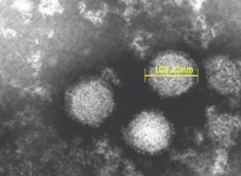 Sốt giảm tiểu cầu là một bệnh truyền nhiễm do bọ ve mang virus SFTS đốt. (Nguồn: LabMedica)