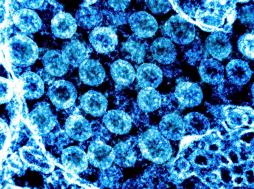 Virus SARS-CoV-2. (Ảnh: AFP/TTXVN)