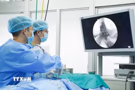 Bác sỹ Bệnh viện Chợ Rẫy thực hiện phẫu thuật lấy khối u tuyến yên khổng lồ cho bệnh nhân bằng Hệ thống phẫu thuật nội soi thần kinh hiện đại. (Ảnh: TTXVN phát)