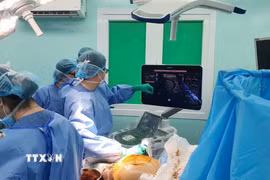 Các bác sỹ Bệnh viện Đại học Y dược Thành phố Hồ Chí Minh can thiệp tắc mạch khối u nhau thai để giúp thai nhi an toàn trong bụng mẹ. Ảnh: TTXVN phát