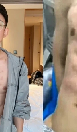 Cơ bụng nhân tạo của Andy Hao Tienan,. (Nguồn: odditycentral.com)