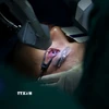 Phẫu thuật mắt bằng tia laser cho bệnh nhân. (Ảnh: Hồng Đạt/TTXVN)