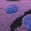 Ảnh huỳnh quang miễn dịch 3D cho thấy các tế bào u hắc tố (màu tím hồng) bị nhiễm vi khuẩn (màu xanh ngọc); nhân tế bào có màu xanh lam. (Nguồn: Viện Khoa học Weizmann)