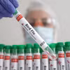 Australia lần đầu tiên phát hiện virus cúm gia cầm H5N1 trên lãnh thổ
