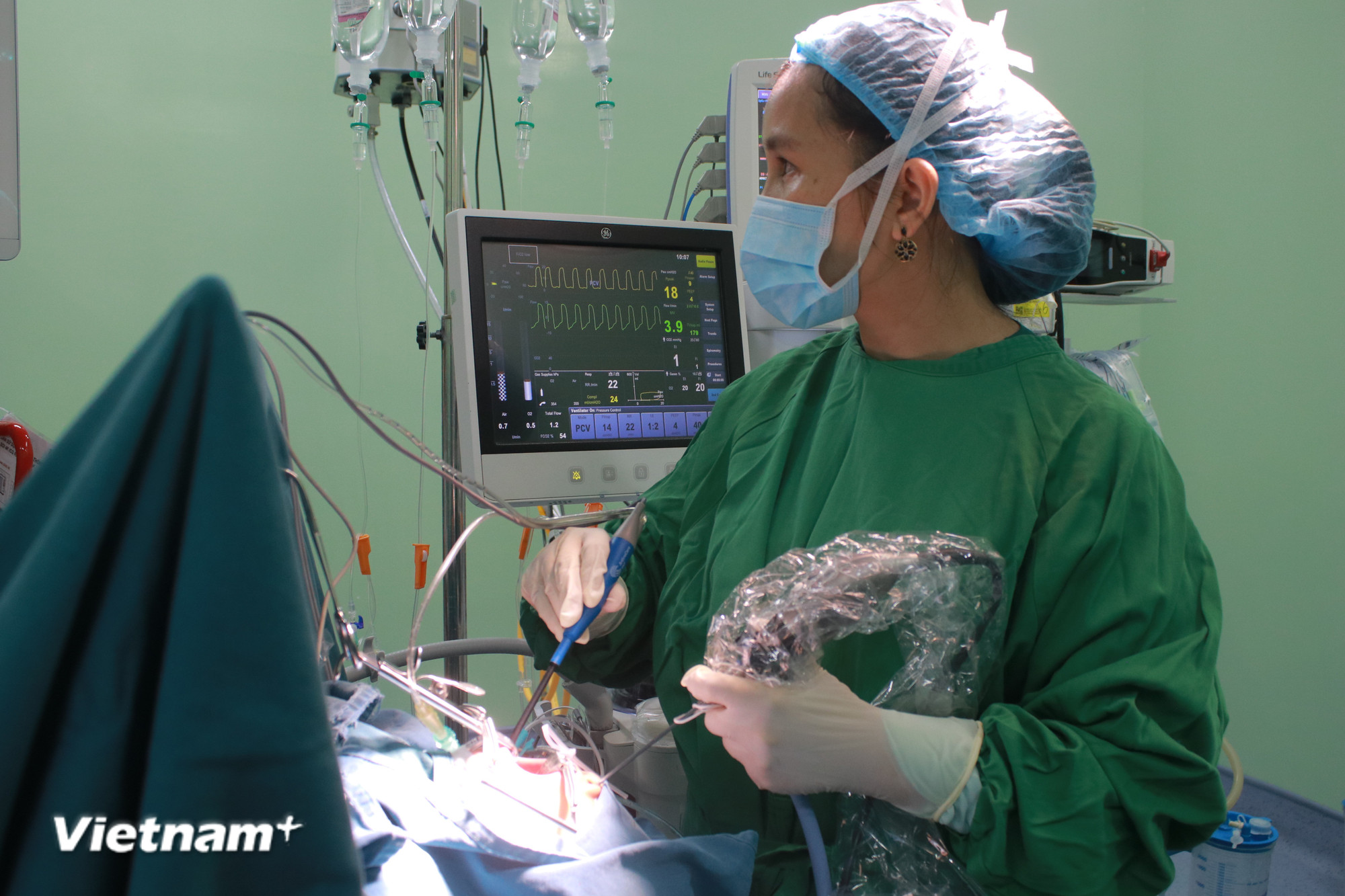 Bác sỹ Phí Thị Quỳnh Anh thực hiện một ca phẫu thuật cho trẻ. (Ảnh: Thùy Giang/Vietnam+)