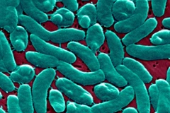 Vi khuẩn ăn thịt người Linard Lyons. (Nguồn: CNN)