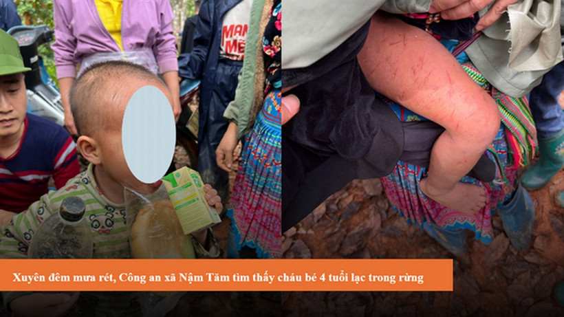 Cháu bé được tìm thấy với nhiều vết xước trên cơ thể. (Nguồn: Công an tỉnh Lai Châu)