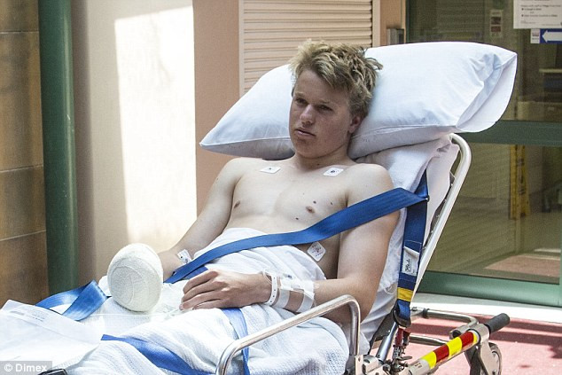 Smith đã sử dụng súng bắn lao để tấn công con cá mập. Trong lúc giằng co, con cá mập đã cắn vào tay của Sam và khiến anh bị thương năng. (Nguồn: 7 News Sydney)