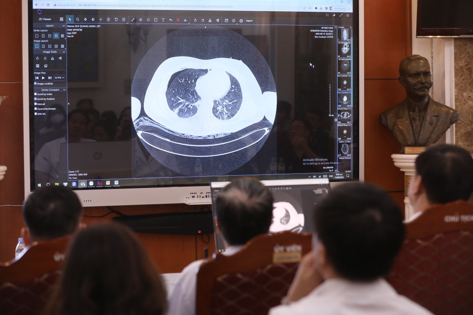 Các bác sỹ Bệnh viện Bạch Mai hội chẩn toàn viện về các nạn nhân vụ cháy trong sáng 13/9. (Ảnh: Minh Quyết/TTXVN)