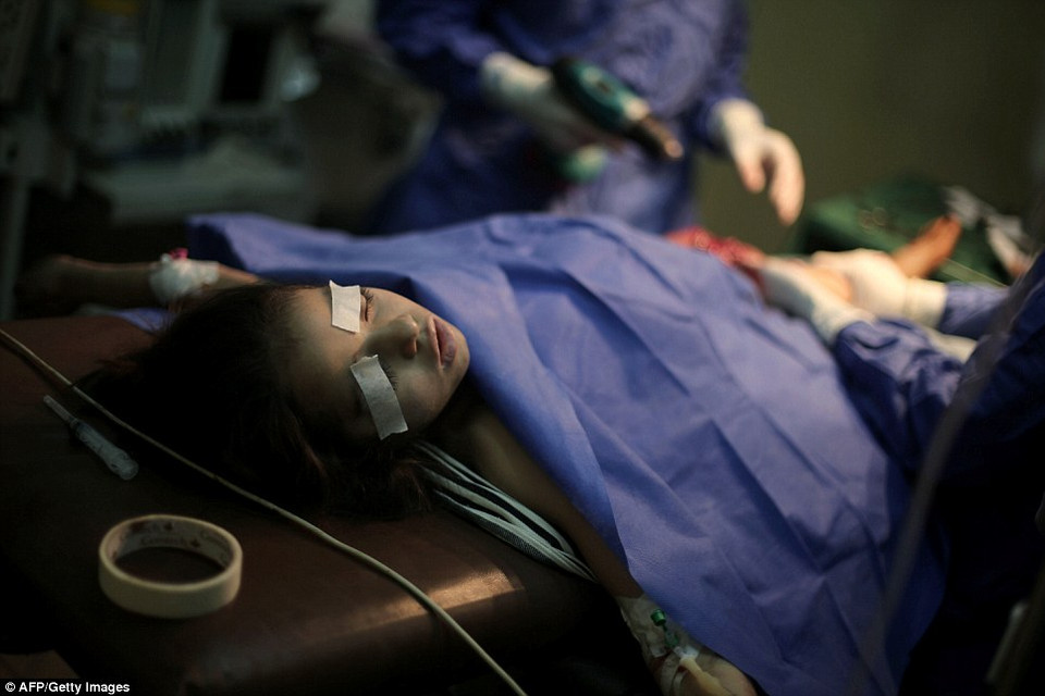 Các bác sỹ tiến hành phẫu thuật cho bé gái Amal Badran (10 tuổi). Badran bị thương nặng khi bom rơi gần một trường học ở Douma. (Nguồn: AFP)
