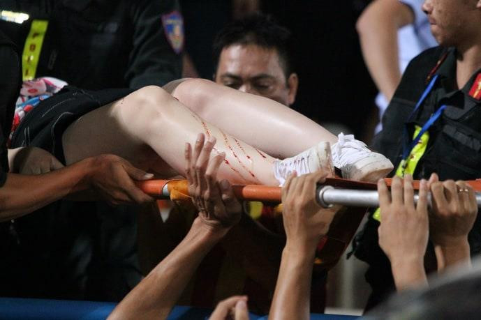 Cô đã được các nhân viên y tế sơ cứu, và băng bó vết thương kịp thời. (Ảnh: Vietnam+)