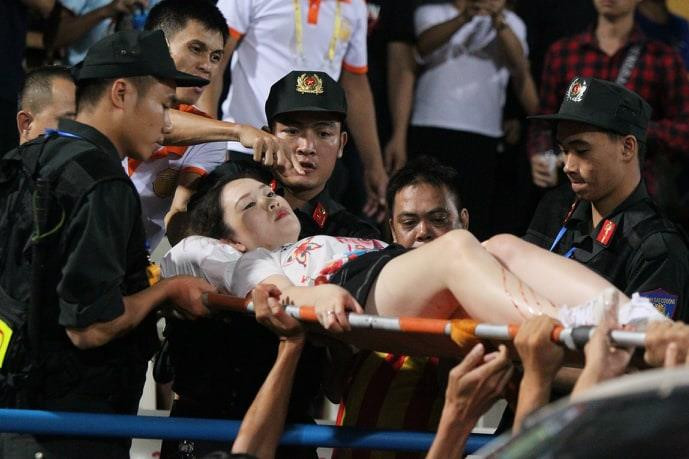 Trước đó, nữ cổ động viên này đã bị một quả pháo thăng thiên bắn trúng khi đang theo dõi trận Hà Nội FC-Nam Định tại Hàng Đẫy. (Ảnh: Vietnam+)