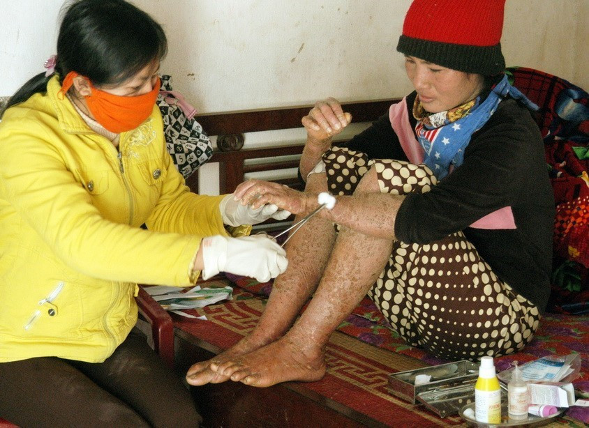 Đồng đẳng viên của nhóm Vì ngày mai tươi sáng (Ninh Bình) chăm sóc bệnh nhân AIDS tại cộng đồng. (Ảnh: Dương Ngọc/TTXVN)