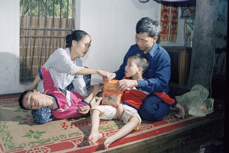 Vợ chồng anh Hoàng Nguyên Hòa và chị Nguyễn Thị Ân ở xã Quỳnh Văn, huyện Quỳnh Lưu, tỉnh Nghệ An đều ở chiến trường trở về, có 2 con bị di chứng chất độc da cam/dioxin. Các cháu đều được nhận trợ cấp thường xuyên hàng tháng từ tỉnh (2002). (Ảnh: Phùng Triệu/TTXVN)