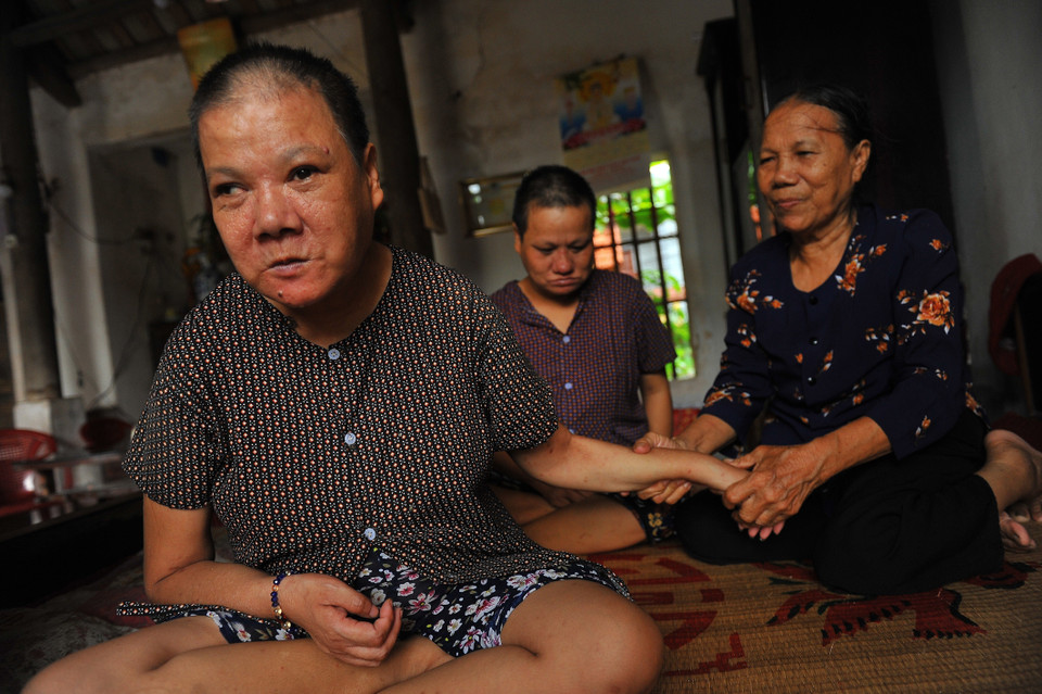 Bà Vũ Thị Dơn tại xóm Chùa, xã Khánh Nhạc, huyện Yên Khánh có 2 con gái (sinh năm 1969 và 1975) đều bị bệnh tâm thần do ảnh hưởng chất độc da cam/dioxin. (Ảnh: Minh Đức/TTXVN)