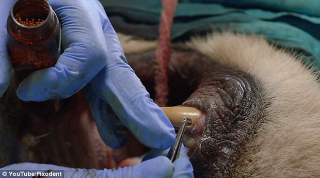 Quá trình phẫu thuật kéo dài bốn tiếng. (Nguồn: Daily Mail)