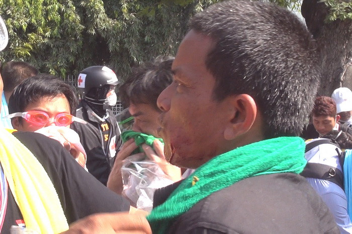 Người biểu tình bị thương sau một cuộc tấn công của họ vào tòa nhà Chính phủ. (Ảnh: Hà Linh/TTXVN)