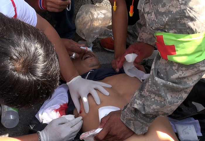 Người biểu tình bị thương sau một cuộc tấn công của họ vào tòa nhà Chính phủ. (Ảnh: Hà Linh/TTXVN)