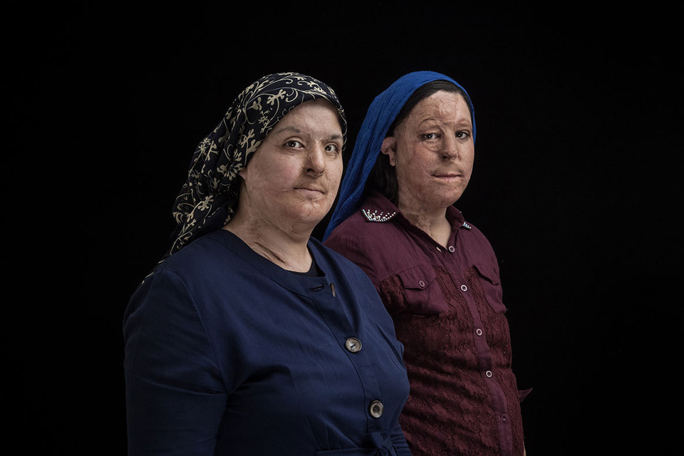 Maryam Zamani (38 tuổi) và Arezo Hashemi Nezhad (13 tuổi) ở Tehran bị chị dâu tạt axít trong lúc đang ngủ. Khuôn mặt của Maryam và Arezo đã bị biến dạng sau vụ tấn công.