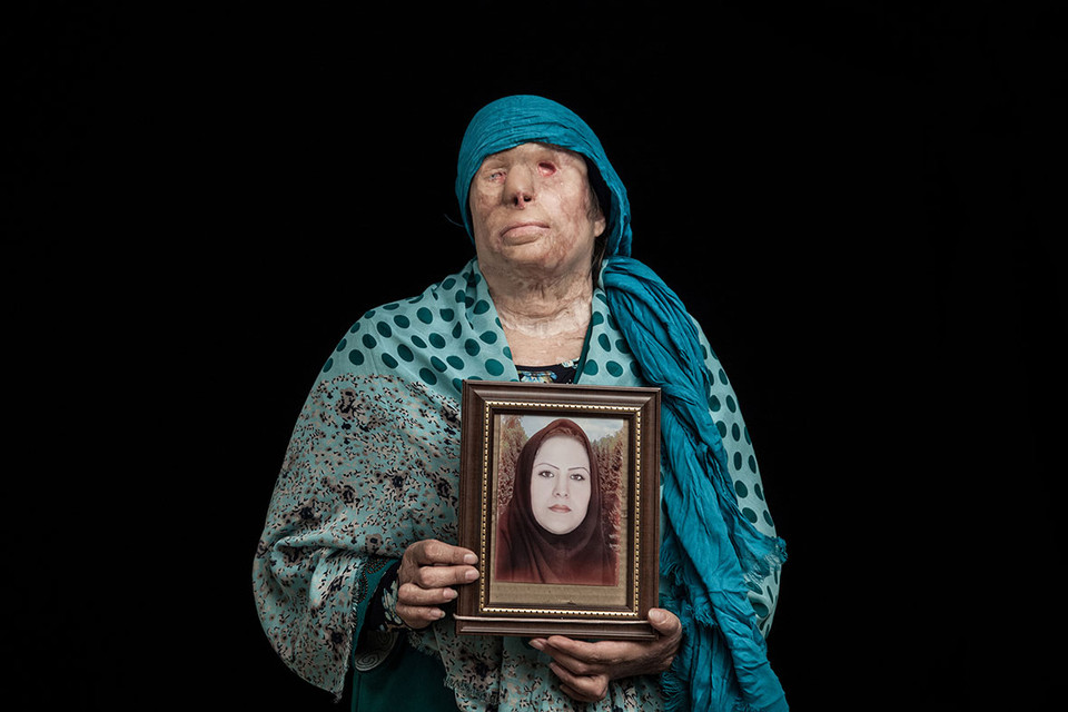 Zivar Parvin (37 tuổi) ở Sarabeleh, miền tây Iran giữ lại bức ảnh trước khi cô bị tạt axít. Sau khi chồng mất, người anh rể đã cầu hôn Zivar nhưng cô quyết định từ chối. Vào 9/7/2011, người đàn ông vô nhân tính đã ném bốn lít axit lên người Zivar và cô con gái Yasra của cô khi họ đang ngủ. Vụ tấn công xảy ra chỉ một tuần trước lễ cưới của Yasra. Mười tám ngày sau khi diễn ra cuộc tấn công axit, Yasra đã qua đời. Mắt trái của Zivar đã hỏng hoàn toàn và khuôn mặt của bà bị biến dạng.