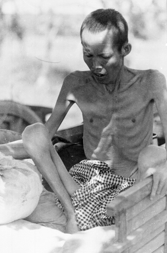 Người dân Campuchia bị đày đọa trong chế độ diệt chủng Pol Pot. Hàng triệu người Campuchia đã bị giết trong những năm cầm quyền của khơ me đỏ tại nước này. (Ảnh: TTXVN)