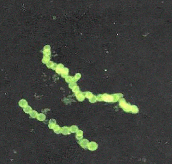 Loài vi khuẩn lớn nhất được biết đến, Thiomargarita namibiensis, có thể đạt đường kính tối đa 0,7mm, đủ lớn để bạn có thể nhìn thấy mà không cần kính hiển vi. Bình thường, đường kính trung bình của vi khuẩn là khoảng 0,001mm. (Nguồn: Boredpanda)