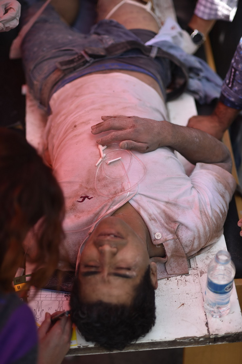 Một người bị thương trong trận động đất ở Mexico City ngày 19/9. (Nguồn: AFP/TTXVN)