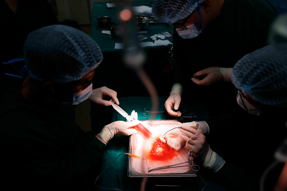 Khâu rửa thận trước khi ghép cho bệnh nhân. (Ảnh: Minh Quyết/TTXVN)