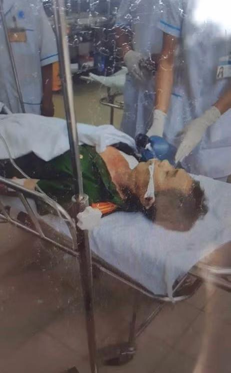 Theo Bộ Công an, hiện nước ta có khoảng hơn 224.000 người nghiện ma túy có hồ sơ quản lý, thấp hơn nhiều so với thực tế. Tệ nạn ma túy đã gây ra nhiều hậu quả, hệ lụy cho đời sống xã hội. Trong ảnh: Sáng ngày 25/12/2018, tại thành phố Phan Thiết (Bình Thuận), một thanh niên nghi bị ngáo đá đã cầm dao ra quốc lộ 1A chặn xe, gây ùn tắc giao thông và đâm chết Trung tá Trần Văn Dũng, Trưởng Công an xã Tiến Lợi (trong ảnh) khi đang thuyết phục, khống chế đối tượng. (Ảnh: Nguyễn Thanh/TTXVN)