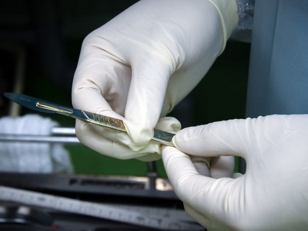 Hy hữu bác sỹ gỡ bỏ quả thận của bệnh nhân vì nhầm tưởng là khối u ảnh 1