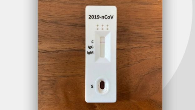 Anh thừa nhận các bộ xét nghiệm kháng thể COVID-19 không đủ chính xác ảnh 1