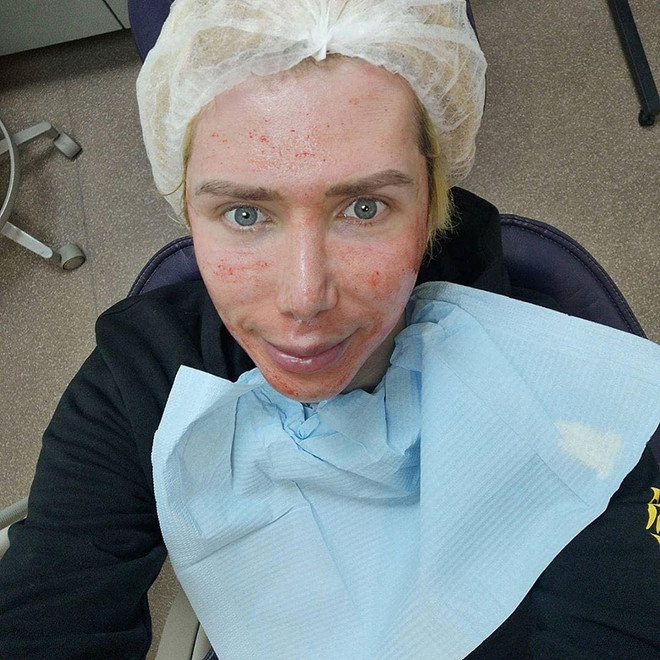 Người đàn ông Anh quốc phẫu thuật cho mình giống thần tượng K-pop ảnh 2