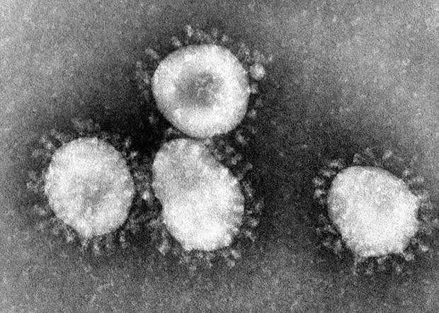 Chuyên gia: Virus gây bệnh viêm phổi lạ lây từ người sang người ảnh 1